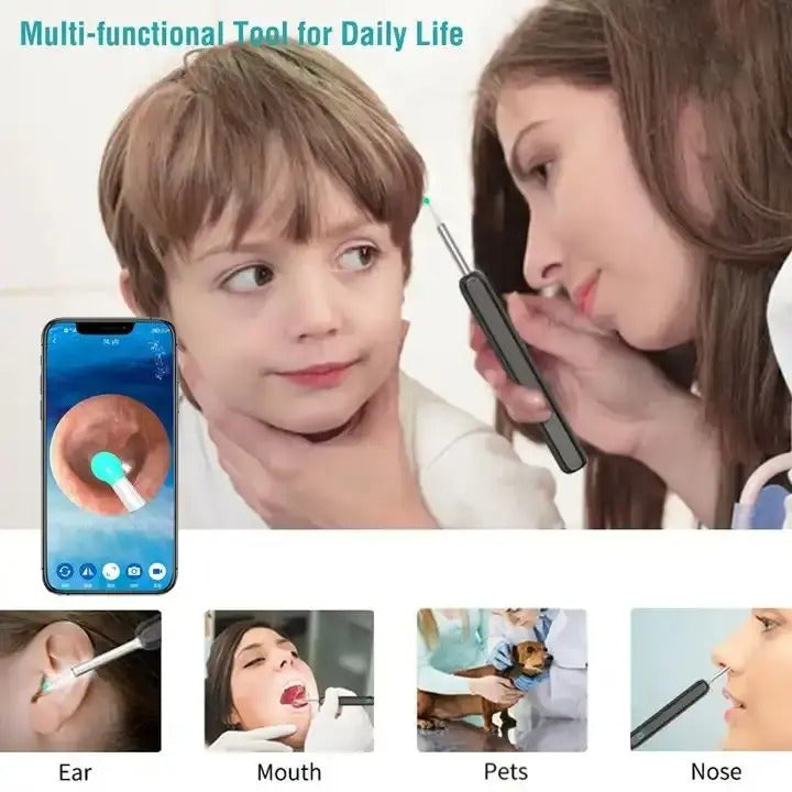 Wireless Earwax Removal Kit with HD Otoscope